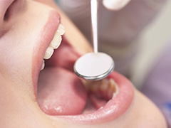 治療から予防へシフトして歯を守る