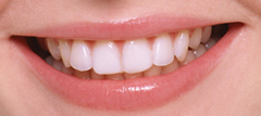 ホワイトニングで白く美しい歯を取り戻しましょう